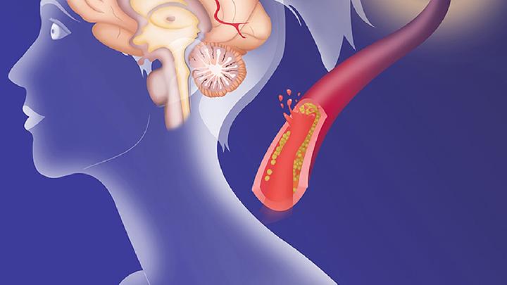 睡前90度倒竖腿的优点